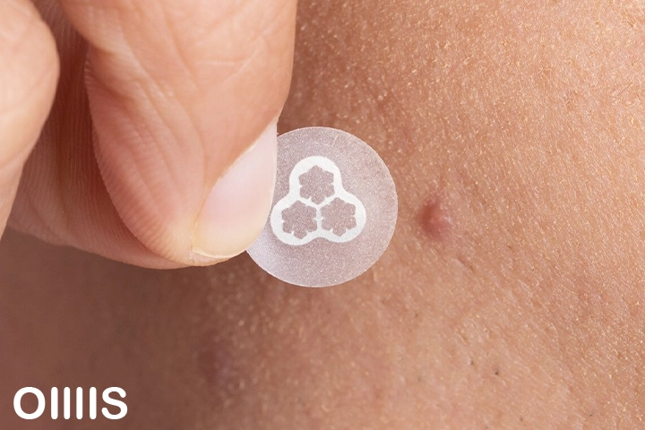 pimple patches close up picture for learning how to use it