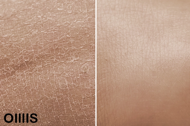 a close up from a dry skin and clear skin