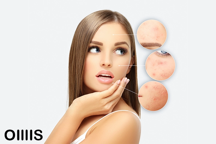 a woman thinking of her skin problems on her face skin